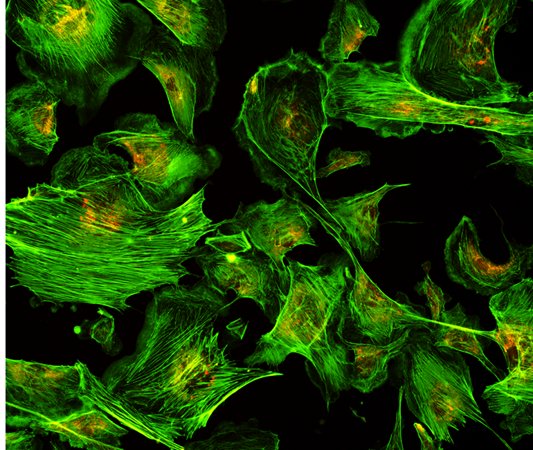 Fluorescent Motorized Microscope Application