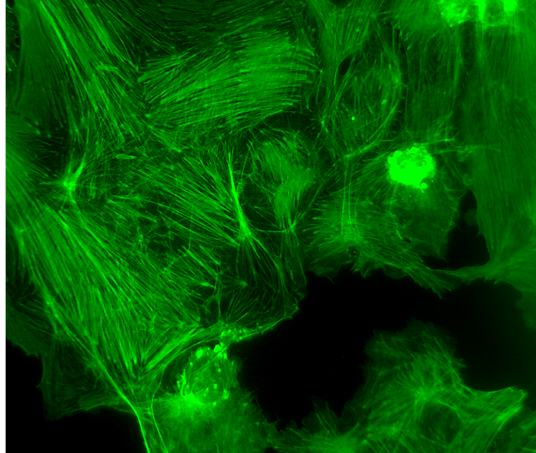 Fluorescence Actual Observation Effect