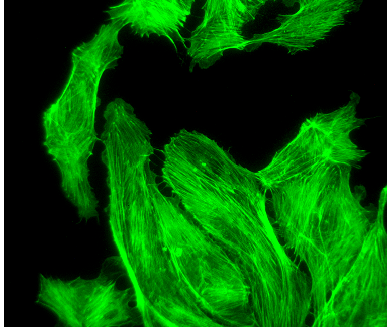 Fluorescent Motorized Microscope Application