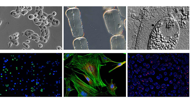 A16.1099 Inverted Fluorescent Microscope, Full Auto, Semi-APO, BF+PH+FL+DIC+Hoffman