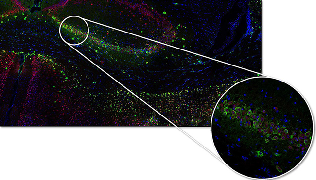 A64.1020 NIR Laser Confocal Microscope, Full Auto, APO, BF+PH+PL+FL+DIC+Hoffman
