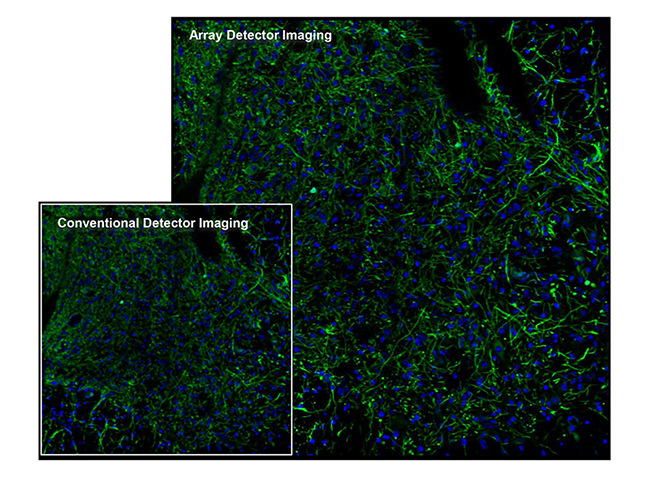 A64.1020 NIR Laser Confocal Microscope, Full Auto, APO, BF+PH+PL+FL+DIC+Hoffman