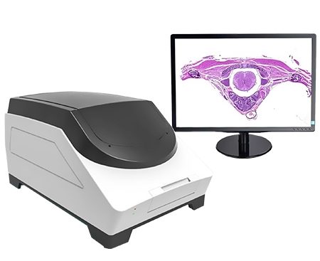 Adding a microscope slide scanner to daily lab work changes how doctors handle and store tissue samples